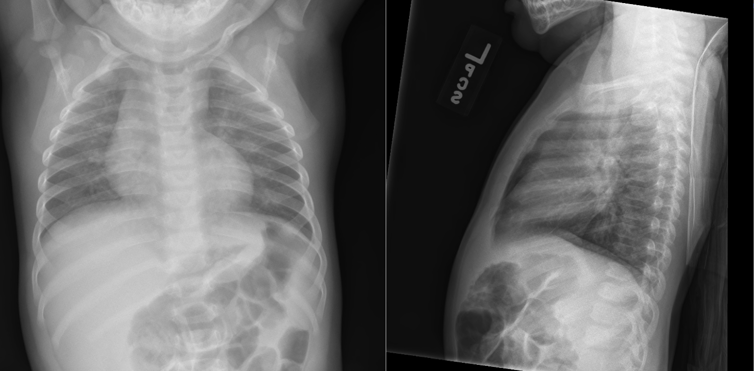 PEM Blog - Chest X-Ray Challenge!